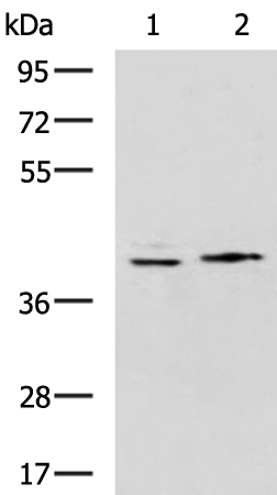Rabbit Polyclonal Antibody to POLB