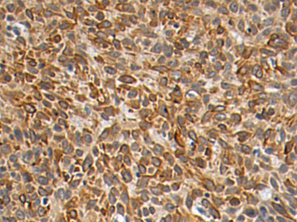 Rabbit Polyclonal Antibody to TRIM15