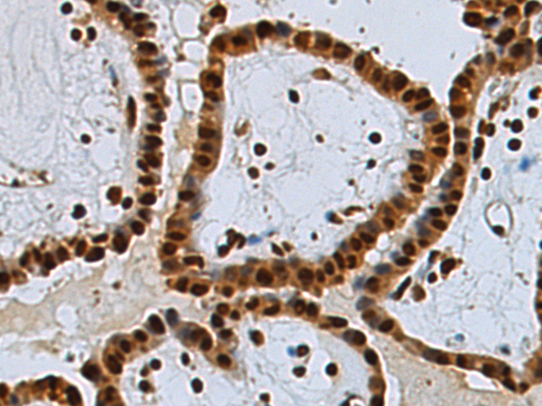 Rabbit Polyclonal Antibody to UBE2O