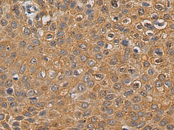 Rabbit Polyclonal Antibody to SNX17
