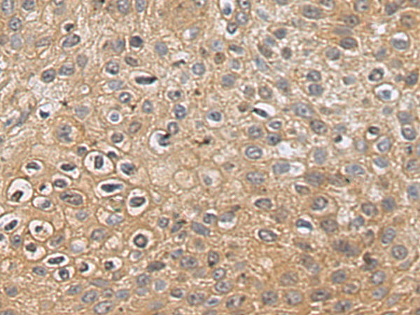 Rabbit Polyclonal Antibody to CORO2B