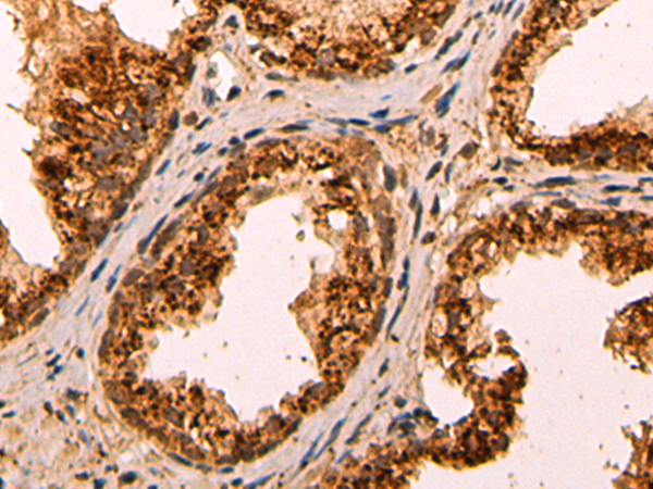 Rabbit Polyclonal Antibody to SCARB2
