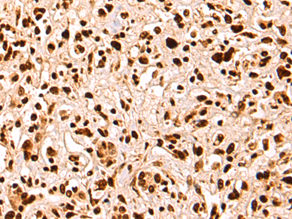 Rabbit Polyclonal Antibody to NCL