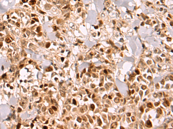 Rabbit Polyclonal Antibody to ZNF639