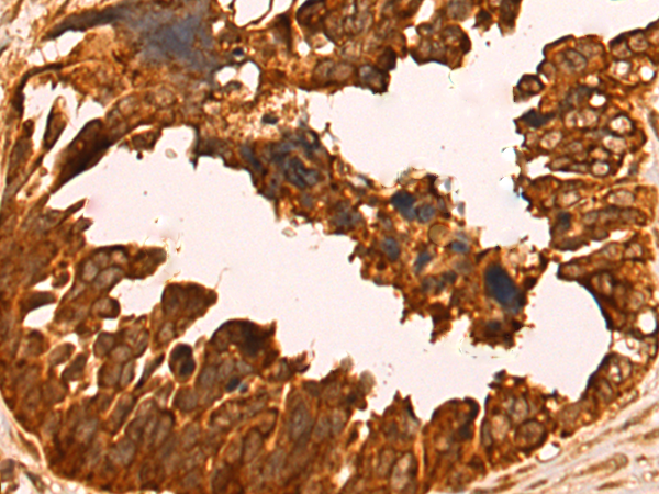 Rabbit Polyclonal Antibody to KLHL29