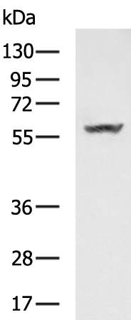 Rabbit Polyclonal Antibody to MYOC