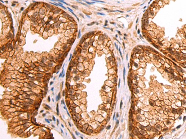 Rabbit Polyclonal Antibody to PCYOX1