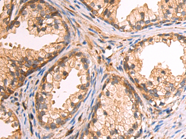 Rabbit Polyclonal Antibody to OSGIN2