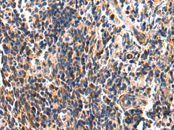 Rabbit Polyclonal Antibody to RNF213