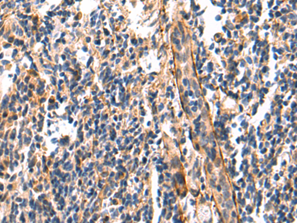 Rabbit Polyclonal Antibody to JADE1