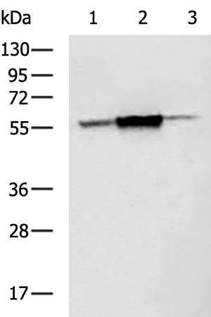Rabbit Polyclonal Antibody to CYP51A1