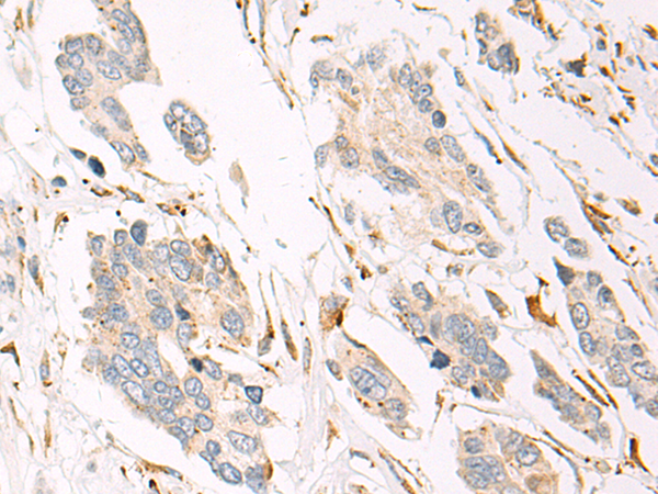 Rabbit Polyclonal Antibody to P4HA2