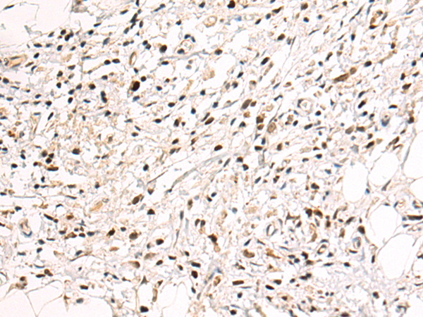 Rabbit Polyclonal Antibody to KPNA6