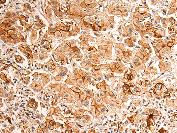 Rabbit Polyclonal Antibody to PALMD