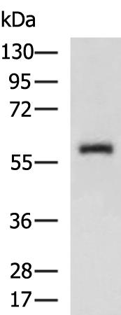 Rabbit Polyclonal Antibody to ABHD16A