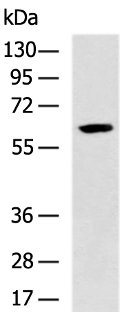 Rabbit Polyclonal Antibody to CES1
