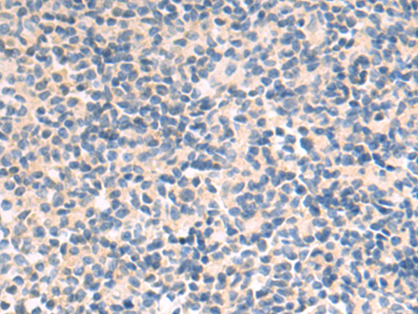 Rabbit Polyclonal Antibody to PIK3R1