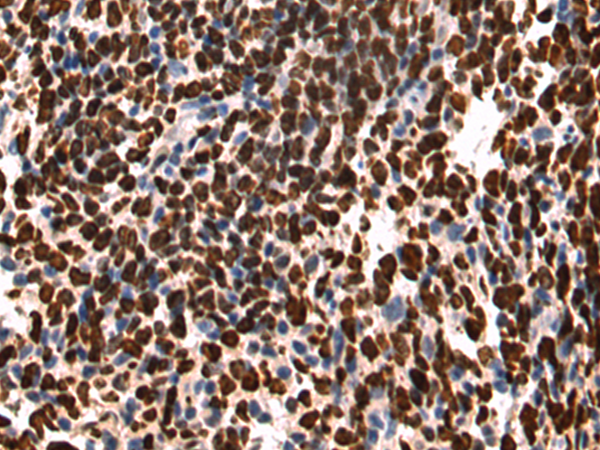 Rabbit Polyclonal Antibody to MKI67