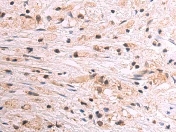 Rabbit Polyclonal Antibody to CDKN2A
