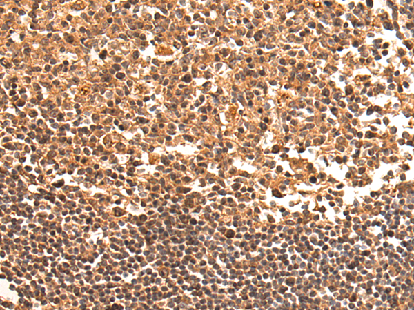 Rabbit Polyclonal Antibody to TSR1