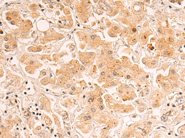 Rabbit Polyclonal Antibody to ZDHHC5