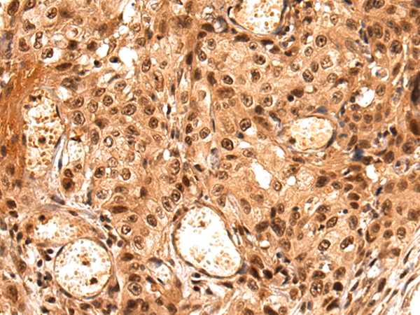 Rabbit Polyclonal Antibody to LEO1