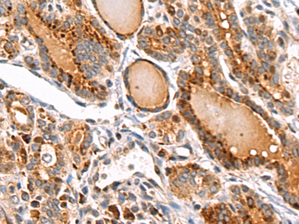 Rabbit Polyclonal Antibody to MID2