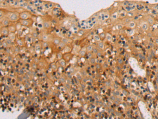Rabbit Polyclonal Antibody to RHPN2
