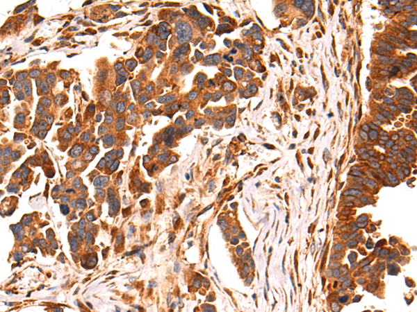 Rabbit Polyclonal Antibody to PLOD3