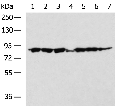 Rabbit Polyclonal Antibody to ZNF184