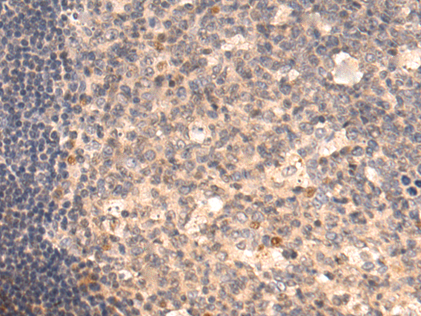 Rabbit Polyclonal Antibody to ARF5