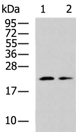 Rabbit Polyclonal Antibody to RPS10