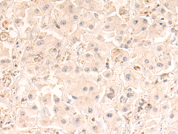 Rabbit Polyclonal Antibody to PLLP