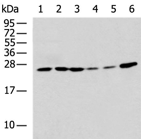 Rabbit Polyclonal Antibody to RPS7