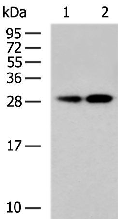 Rabbit Polyclonal Antibody to TRPT1