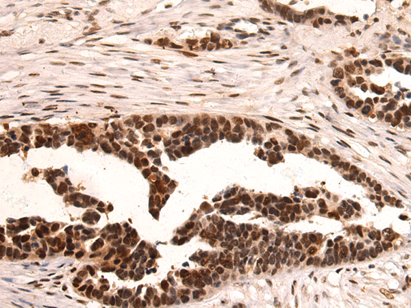 Rabbit Polyclonal Antibody to KPNA1