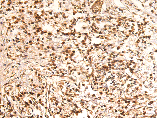 Rabbit Polyclonal Antibody to HJURP