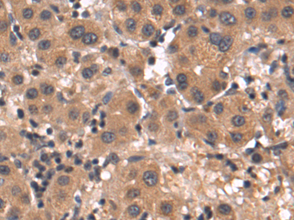 Rabbit Polyclonal Antibody to TCAF1