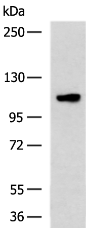 Rabbit Polyclonal Antibody to INTS7