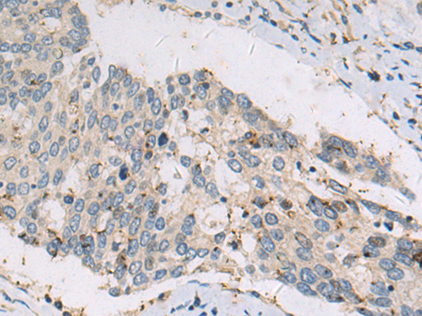 Rabbit Polyclonal Antibody to DHTKD1