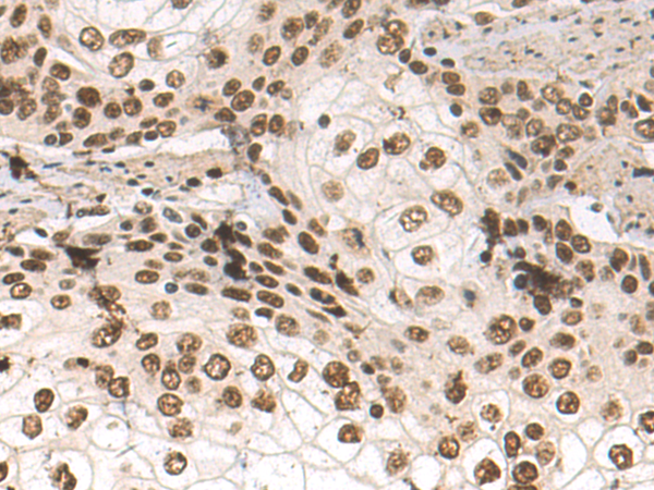 Rabbit Polyclonal Antibody to DDX46