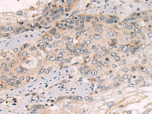 Rabbit Polyclonal Antibody to COPB2