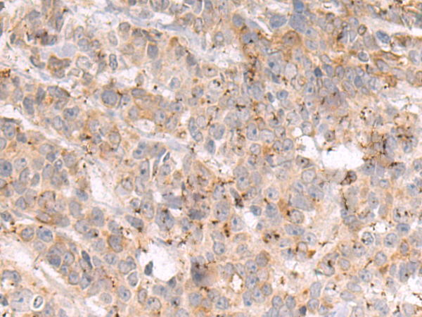 Rabbit Polyclonal Antibody to TDRD7