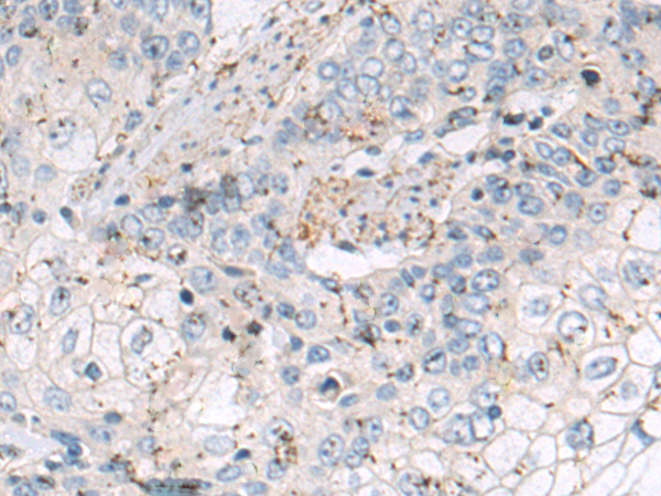Rabbit Polyclonal Antibody to PPFIA1