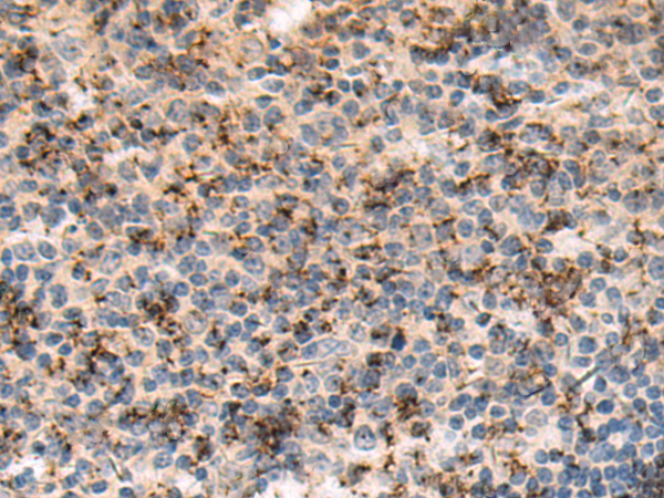Rabbit Polyclonal Antibody to PFDN1