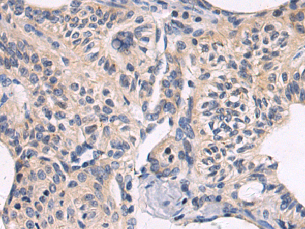 Rabbit Polyclonal Antibody to MYCBP