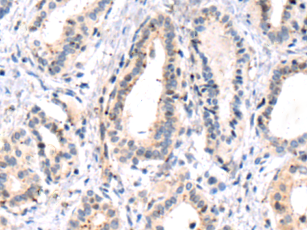 Rabbit Polyclonal Antibody to MYL6B