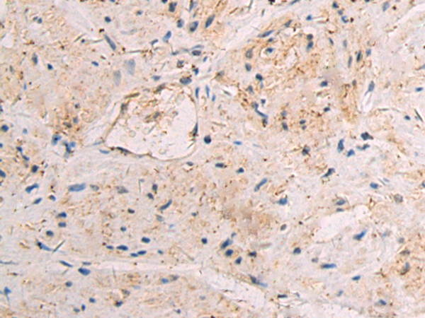 Rabbit Polyclonal Antibody to CIB2