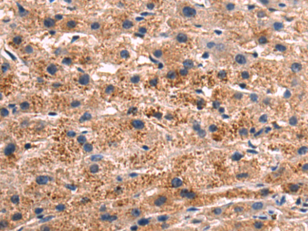Rabbit Polyclonal Antibody to NRARP