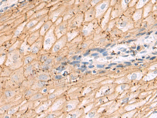 Rabbit Polyclonal Antibody to ARFIP2